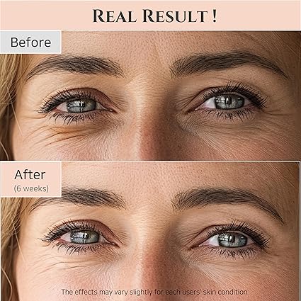 Korean Eye Serum