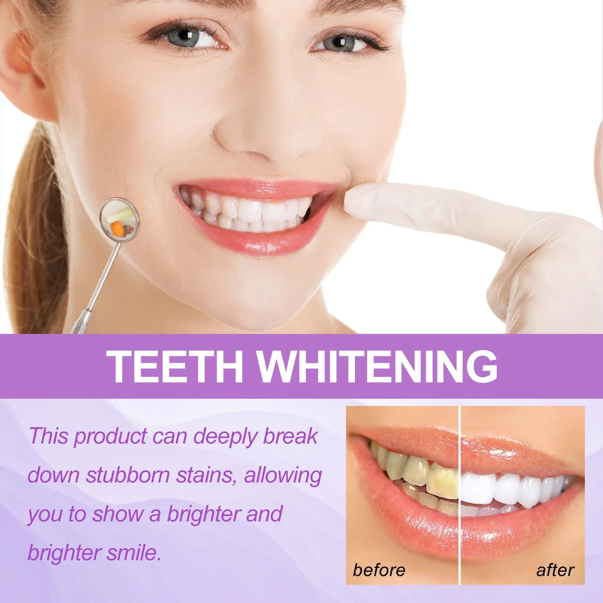 Purple Teeth Whitening 14 Strips