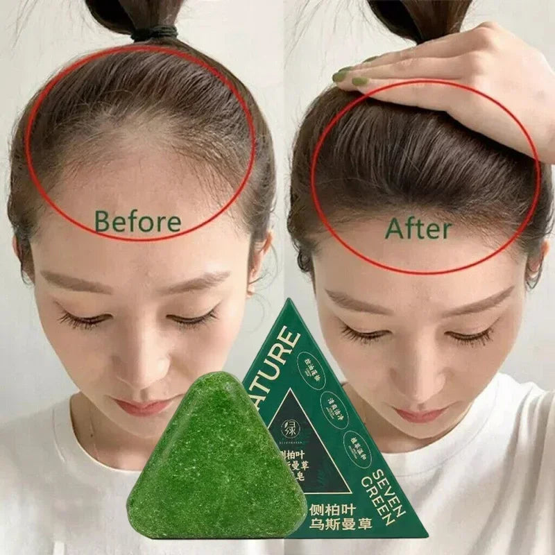 Herbal Anti-Hair Loss Shampoo Bar