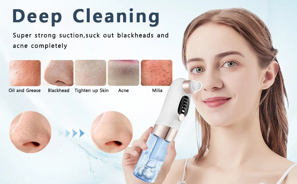 Acne Black Head Deep Clean Removal