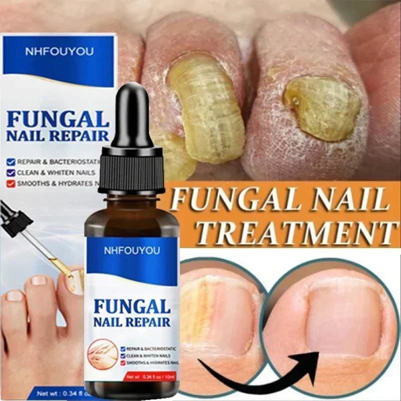 Nail Fungus Defender Serum