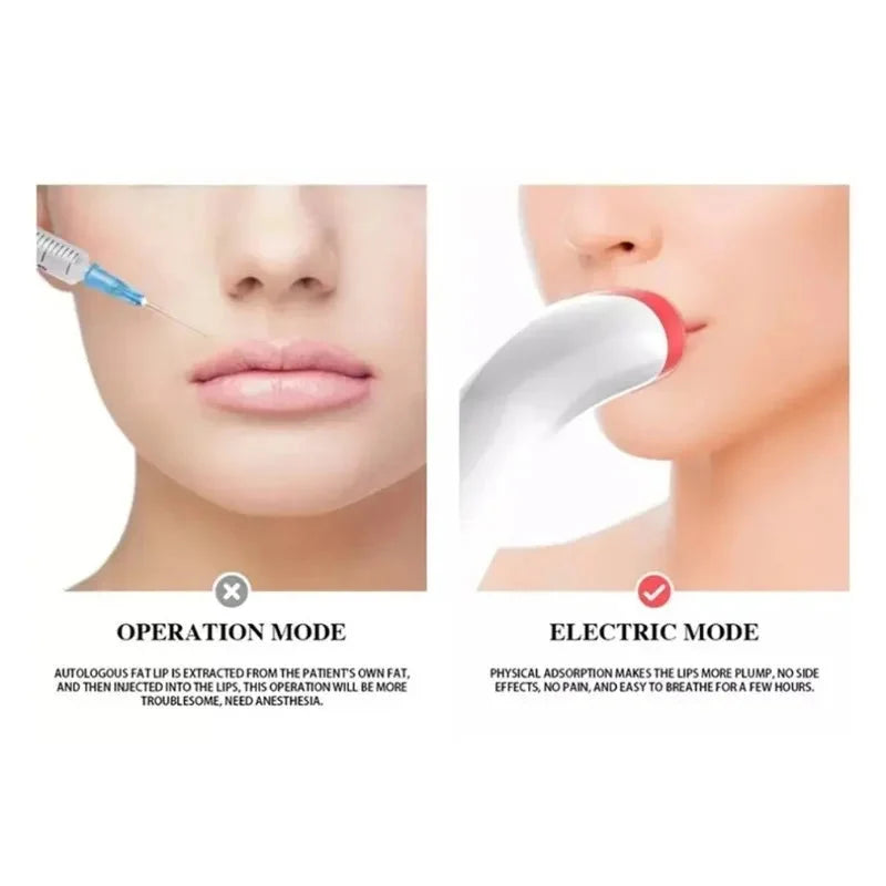 Electric Lip Enhancer Device