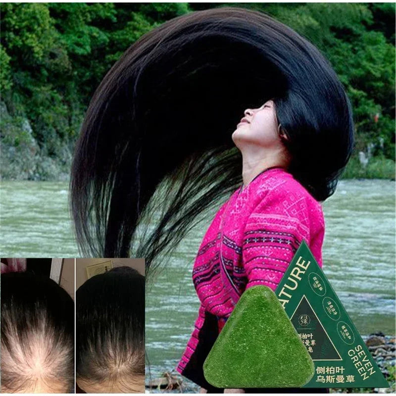 Herbal Anti-Hair Loss Shampoo Bar