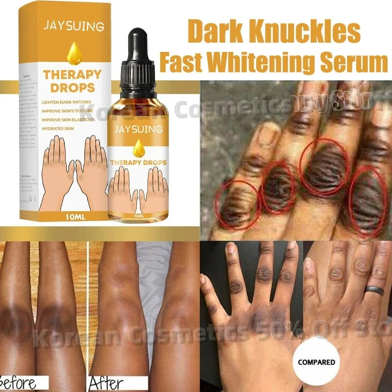 Dark Spot Removal Serum