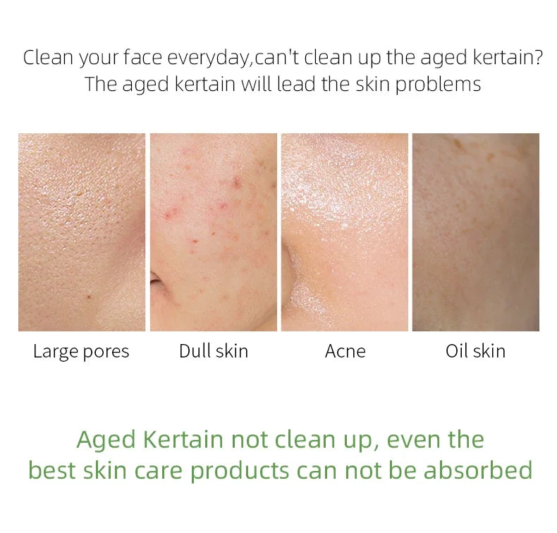 Exfoliating Gel for Whitening Face and Body Skin
