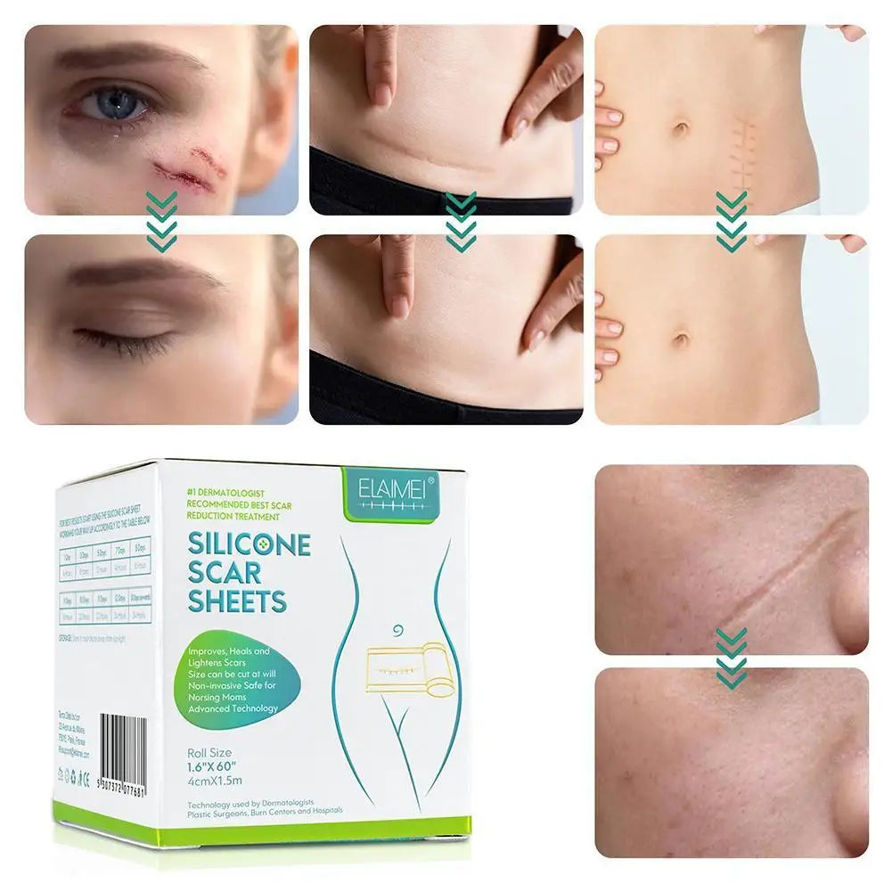 Silicone Gel Scar Repair Patch
