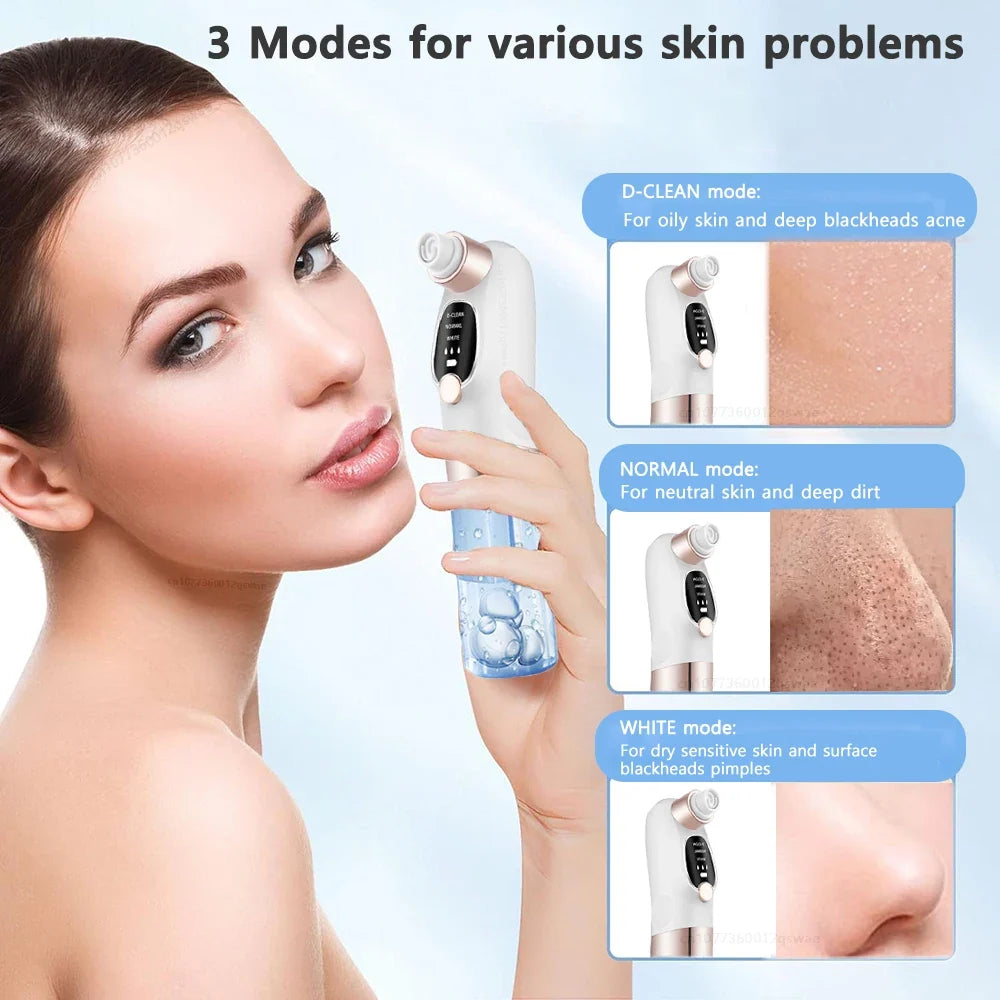 Acne Black Head Deep Clean Removal