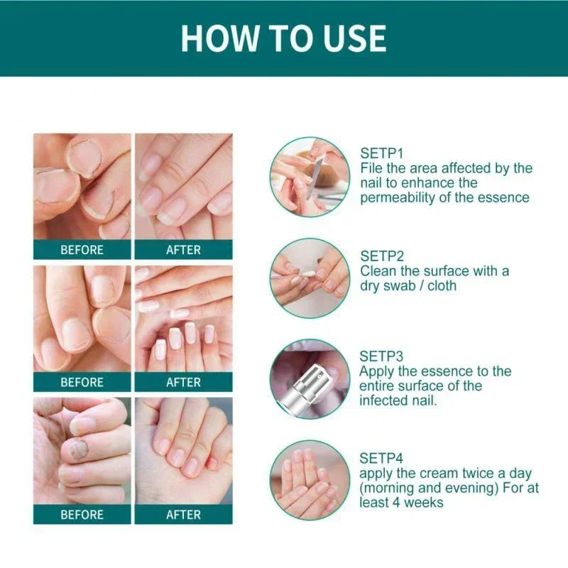 Nail Fungus Defender Serum