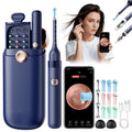 Visual Ear Wax Remover