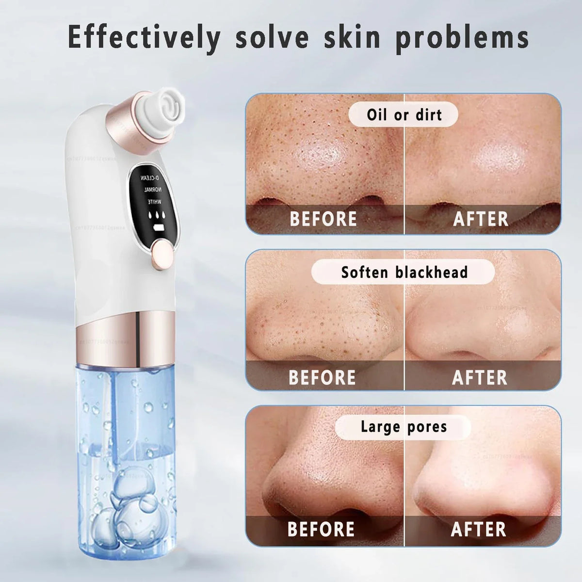 Acne Black Head Deep Clean Removal