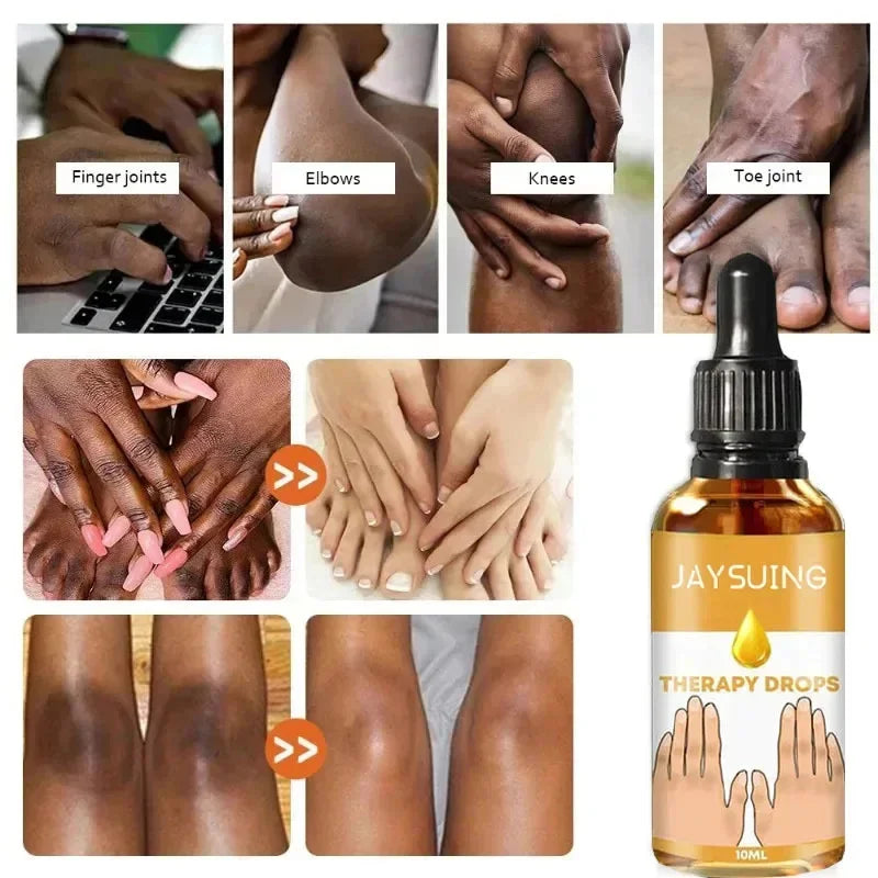 Dark Spot Removal Serum
