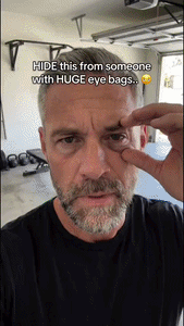 Dark Circle Eye Massager