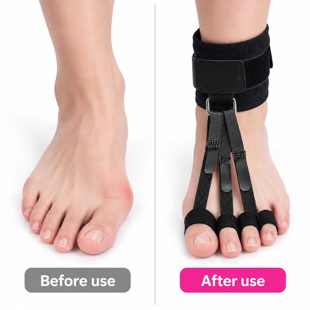 Straight Steps Toe Alignment Brace