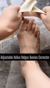 Adjustable Hallux Valgus Bunion Corrector