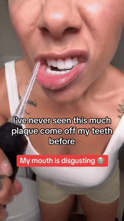USB Oral Care Water Flosser